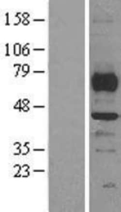 Novus Biologicals&trade;&nbsp;SMYD3 Overexpression Lysate