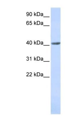 SMYD3 Antibody, Novus Biologicals 100 &mu;L | Buy Online | Novus Biologicals | Fisher Scientific