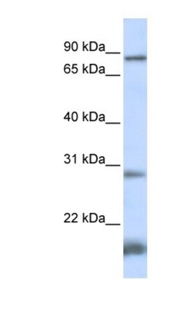 SMYD4 Antibody, Novus Biologicals 0.05mg; Unlabeled:Antibodies, Polyclonal
