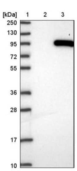 SMYD4 Antibody, Novus Biologicals 0.1mL; Unlabeled:Antibodies, Polyclonal