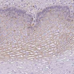 SMYD5 Antibody, Novus Biologicals 0.1mL; Unlabeled:Antibodies, Polyclonal