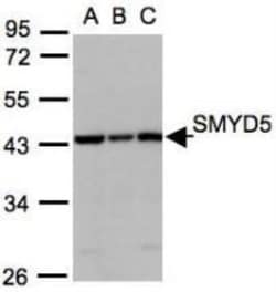 SMYD5 Antibody, Novus Biologicals 0.1 mL | Buy Online | Novus Biologicals | Fisher Scientific