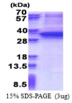 Novus Biologicals Recombinant Human Snail His Protein 0,1 mg | Buy Online | Novus Biologicals&trade; | Fisher Scientific