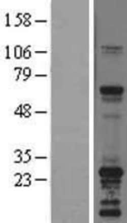 Novus Biologicals&trade;&nbsp;SNAP23 Overexpression Lysate