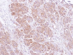 SNAP25 Antibody, Novus Biologicals 0.1mL; Unlabeled:Antibodies, Polyclonal