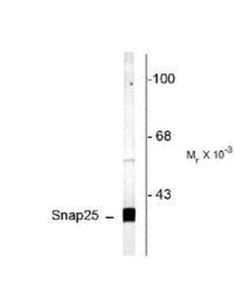 SNAP25 Antibody, Novus Biologicals 0.1mL; Unlabeled:Antibodies, Polyclonal