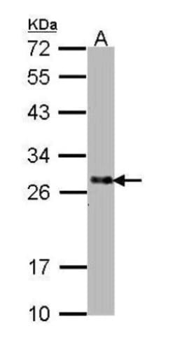 SNAP25 Antibody, Novus Biologicals 0.1mL; Unlabeled:Antibodies, Polyclonal