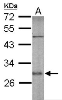SNAP25 Antibody, Novus Biologicals 0.1mL; Unlabeled:Antibodies, Polyclonal