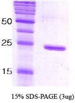 Novus Biologicals&trade;&nbsp;Recombinant C. elegans SNAP25 Protein