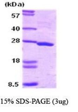 Novus Biologicals&trade;&nbsp;Recombinant Human SNAP25 Protein