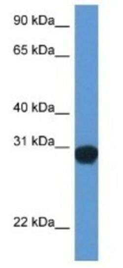 SNAP29 Antibody, Novus Biologicals:Antibodies:Primary Antibodies