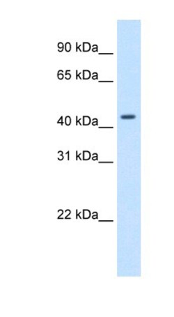 SNAP43 Antibody, Novus Biologicals 100&mu;L; Unlabeled:Antibodies, Polyclonal