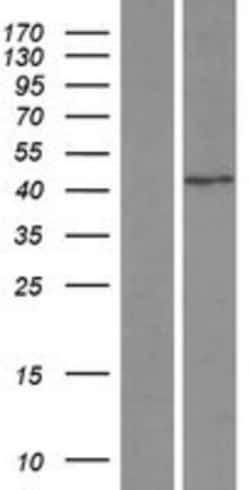 Novus Biologicals&trade;&nbsp;SNAP43 Overexpression Lysate