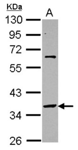 SNAP45 Antibody, Novus Biologicals 0.1mL; Unlabeled:Antibodies, Polyclonal