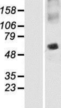 Novus Biologicals&trade;&nbsp;SNAP47 Overexpression Lysate