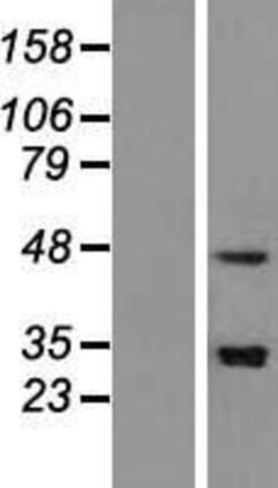 Novus Biologicals&trade;&nbsp;SNAPC3 Overexpression Lysate