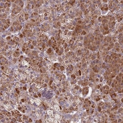 SNAPC4 Antibody, Novus Biologicals:Antibodies:Primary Antibodies