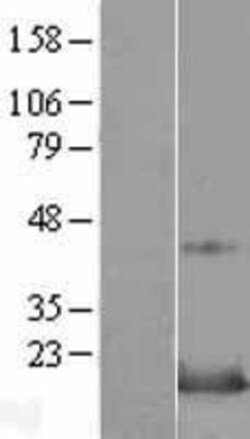 Novus Biologicals&trade;&nbsp;Snapin Overexpression Lysate