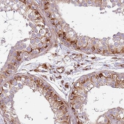 Snapin Antibody, Novus Biologicals 0.1mL; Unlabeled:Antibodies, Polyclonal