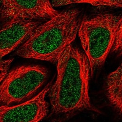 SNED1 Antibody, Novus Biologicals 0.1mL; Unlabeled:Antibodies, Polyclonal