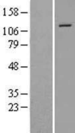 Novus Biologicals™ SMARCA5/SNF2H Overexpression Lysate