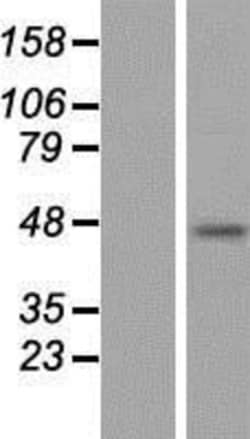 Novus Biologicals&trade;&nbsp;SNF5 Overexpression Lysate