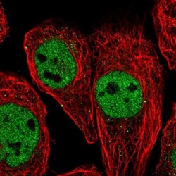 SNF5 Antibody, Novus Biologicals 0.1mL; Unlabeled:Antibodies, Polyclonal