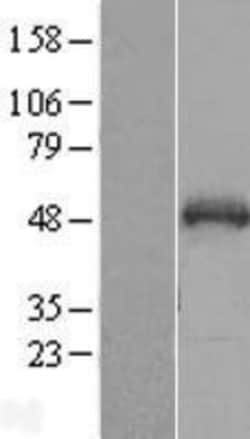 Novus Biologicals&trade;&nbsp;SNIP1 Overexpression Lysate