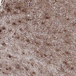 SNIP1 Antibody, Novus Biologicals 0.1mL; Unlabeled:Antibodies, Polyclonal