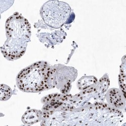 SNM1 Antibody, Novus Biologicals 0.1mL; Unlabeled:Antibodies, Polyclonal