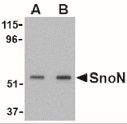 SnoN Antibody, Novus Biologicals:Antibodies:Primary Antibodies