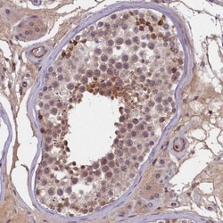SNRK Antibody, Novus Biologicals:Antibodies:Primary Antibodies