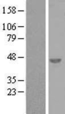 Novus Biologicals&trade;&nbsp;SNRNP48 Overexpression Lysate