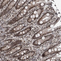 ATE1 Antibody, Novus Biologicals:Antibodies:Primary Antibodies