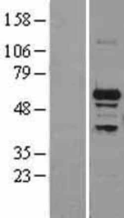 Novus Biologicals&trade;&nbsp;SNRP70 Overexpression Lysate