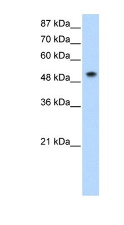 SNRP70 Antibody, Novus Biologicals 0.05mg; Unlabeled:Antibodies, Polyclonal