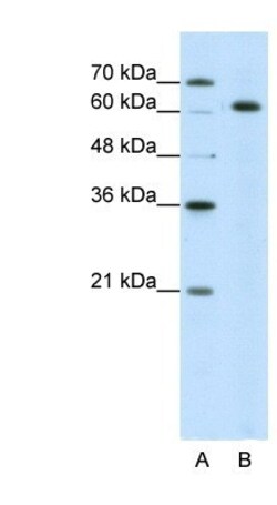 SNRP70 Antibody, Novus Biologicals 0.1mg; Unlabeled:Antibodies, Polyclonal