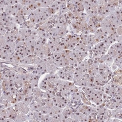 SNRPA1 Antibody, Novus Biologicals:Antibodies:Primary Antibodies