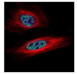 SNRPB Antibody, Novus Biologicals 0.1mL; Unlabeled:Antibodies, Polyclonal