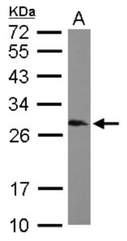 SNRPB Antibody, Novus Biologicals 0.1mL; Unlabeled:Antibodies, Polyclonal