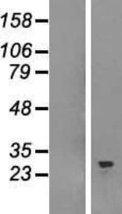 Novus Biologicals&trade;&nbsp;SNRPB Overexpression Lysate