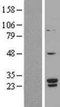 Novus Biologicals™ SNRPB2 Overexpression Lysate