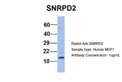 SNRPD2 Antibody, Novus Biologicals 0.05mg; Unlabeled:Antibodies, Polyclonal