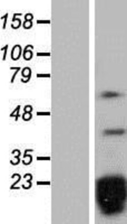 Novus Biologicals™ SNRPD2 Overexpression Lysate
