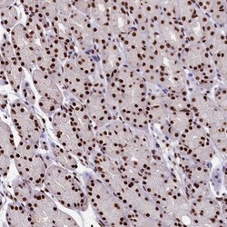 SNRPD2 Antibody, Novus Biologicals 0.1mL; Unlabeled:Antibodies, Polyclonal