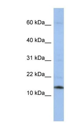 SNRPD2 Antibody, Novus Biologicals 0.05mg; Unlabeled:Antibodies, Polyclonal