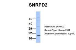 SNRPD2 Antibody, Novus Biologicals 0.05mg; Unlabeled:Antibodies, Polyclonal