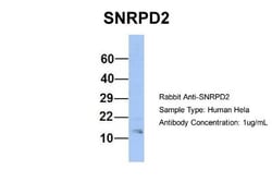 SNRPD2 Antibody, Novus Biologicals 0.05mg; Unlabeled:Antibodies, Polyclonal