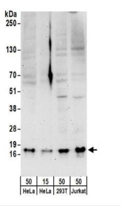 SNRPD3 Antibody, Novus Biologicals 0.1mg; Unlabeled:Antibodies, Polyclonal