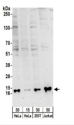 SNRPD3 Antibody, Novus Biologicals 0.1mg; Unlabeled:Antibodies, Polyclonal